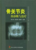 骨关节炎的诊断与治疗