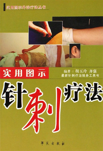 针刺疗法-(实用图示)(最新针刺疗法随身工具书)