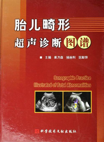 胎儿畸形超声诊断图谱