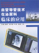 血管导管技术在泌尿科临床的应用