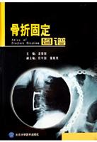 骨折固定图谱