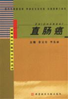 直肠癌