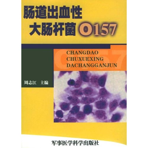 肠道出血性大肠杆菌O157