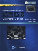 结直肠癌