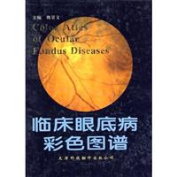 临床眼底病彩色图谱
