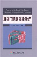 肝癌门静脉癌栓治疗