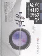 宫腔镜学及图谱-(第二版)