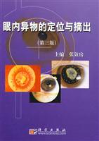 眼内异物的定位与摘出-(第三版)