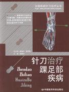 针刀治疗踝足部疾病