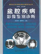盆腔疾病影像鉴别诊断