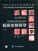 临床皮肤病学:诊断与治疗彩色图解指南