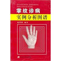 掌纹诊病
