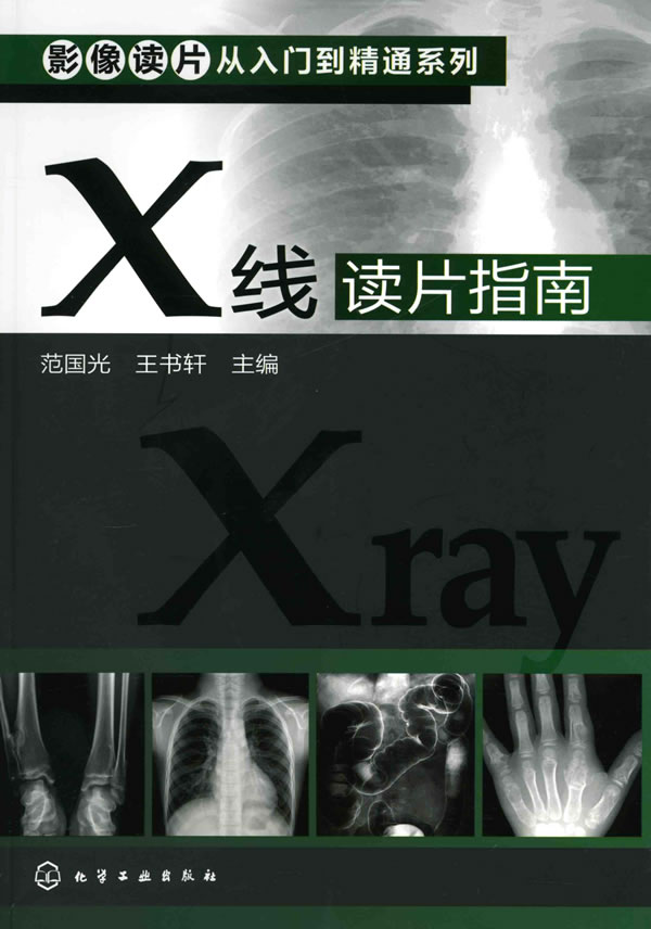 X线 读片指南