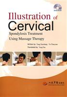 Illustration of Cervical-DVD-ROM