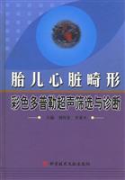 胎儿心脏畸形彩色多普勒超声筛选与诊断