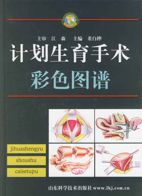 计划生育手术彩色图谱