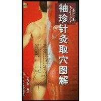 袖珍针炙取穴图解