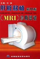 肝脏移植MRI诊断图谱
