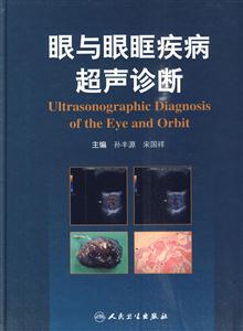 眼和眼眶疾病超声诊断