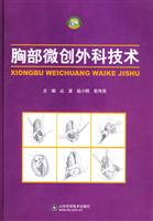 胸部微创外科技术
