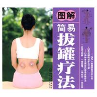 图解简易拔罐疗法