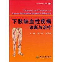 下肢缺血性疾病诊断与治疗-附5种术式手术录像DVD