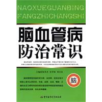 脑血管病防治常识