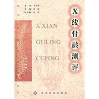 X线骨龄测评