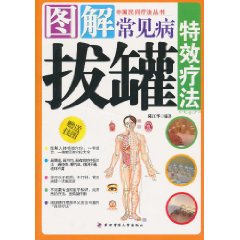 图解常见病拔罐特效疗法-赠送挂图