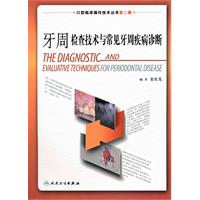 牙周检查技术与常见牙周疾病诊断