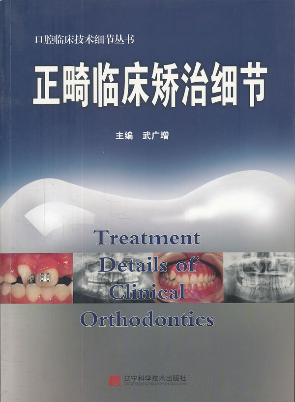 正畸临床矫治细节