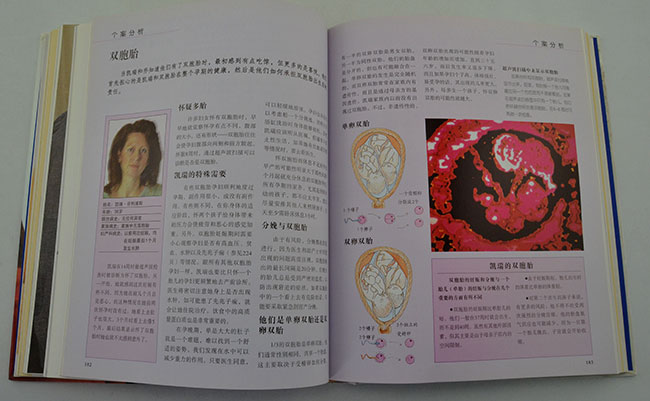 2380311tp10.jpg