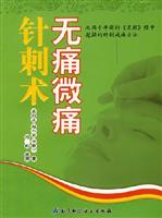 无痛微痛针刺术