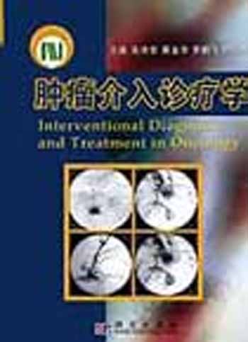 肿瘤介入治疗学