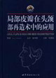 局部皮瓣在头颈部再造术中的应用-技术教育社区