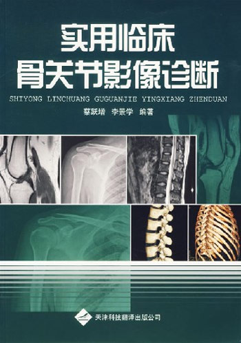 实用临床骨关节影像诊断