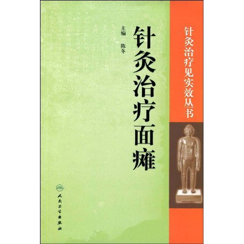 针灸治疗面瘫
