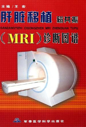 肝脏移植MRI诊断图谱