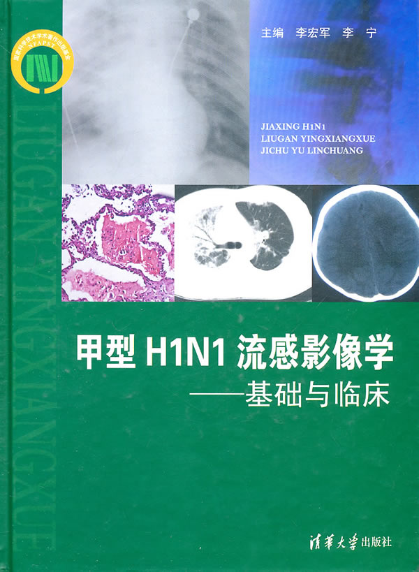 甲型H1N1流感影像学-基础与临床