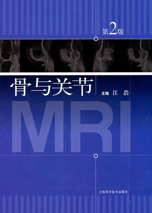 骨与关节MRI-第2版